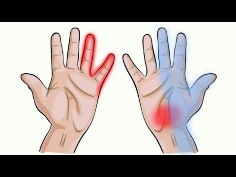 Schmerz unterhalb der Taille auf der linken Seite während der Schwangerschaft Vitamine gegen Osteochondrose