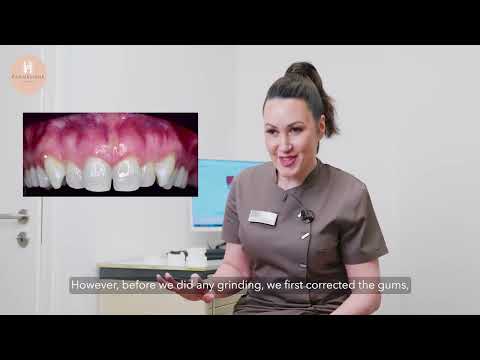 🦷✨ Ein echter Fall aus der Praxis: Beratung auf Augenhöhe