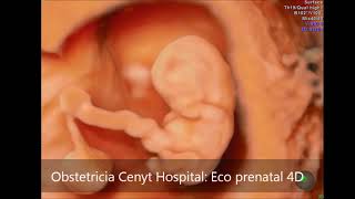 Ecografía prenatal 4D en Cenyt Hospital