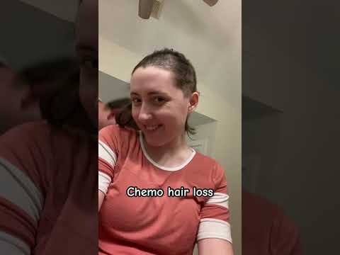 Chemo hair loss journey #breastcancer #cancer #samanthalynn #shorts