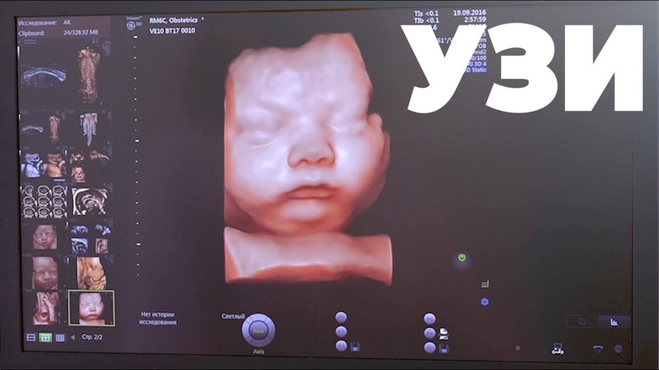 3D УЗИ Календарь  Беременности. Что Делает Ребенок в Животе у Мамы 