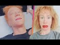 Kathy Griffin Shares SHOCKING Results of Getting Lips Tattooed