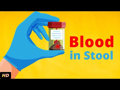 Blood In Stool – What Does It Mean?