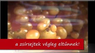 Így használd a Forever Slim zsírbontót! (Purt Kata)