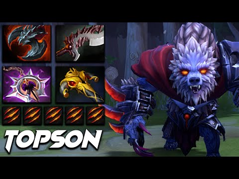 Topson Ursa Bear Warrior - Dota 2 Pro Gameplay [Watch & Learn]