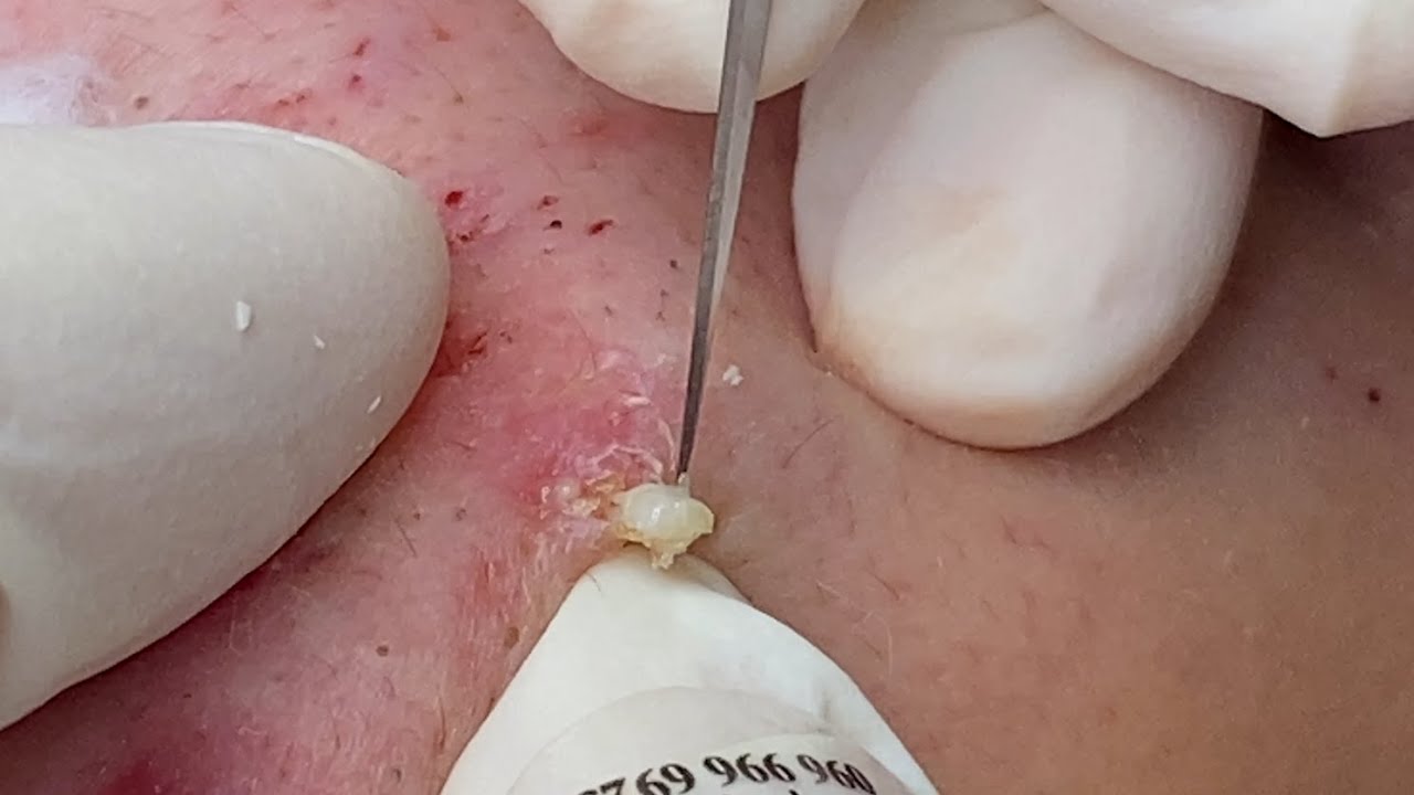 YouTube Thumbnail Downloader FULL HQ IMAGE