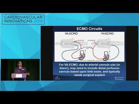 CVI2018 Session: When to use hemodynamic support & device selection - Ajay Kirtane, MD