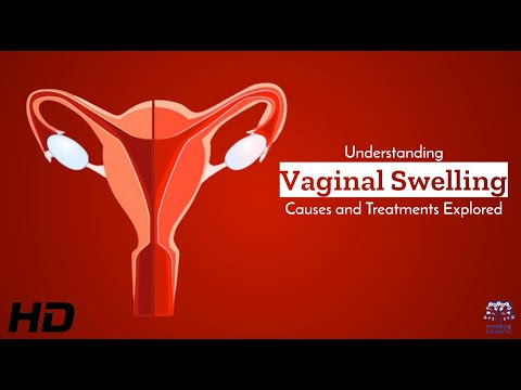 Vaginal Swelling Explained: Insights on Treatment Options