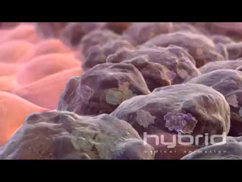 Pemetrexed Injection 100mg