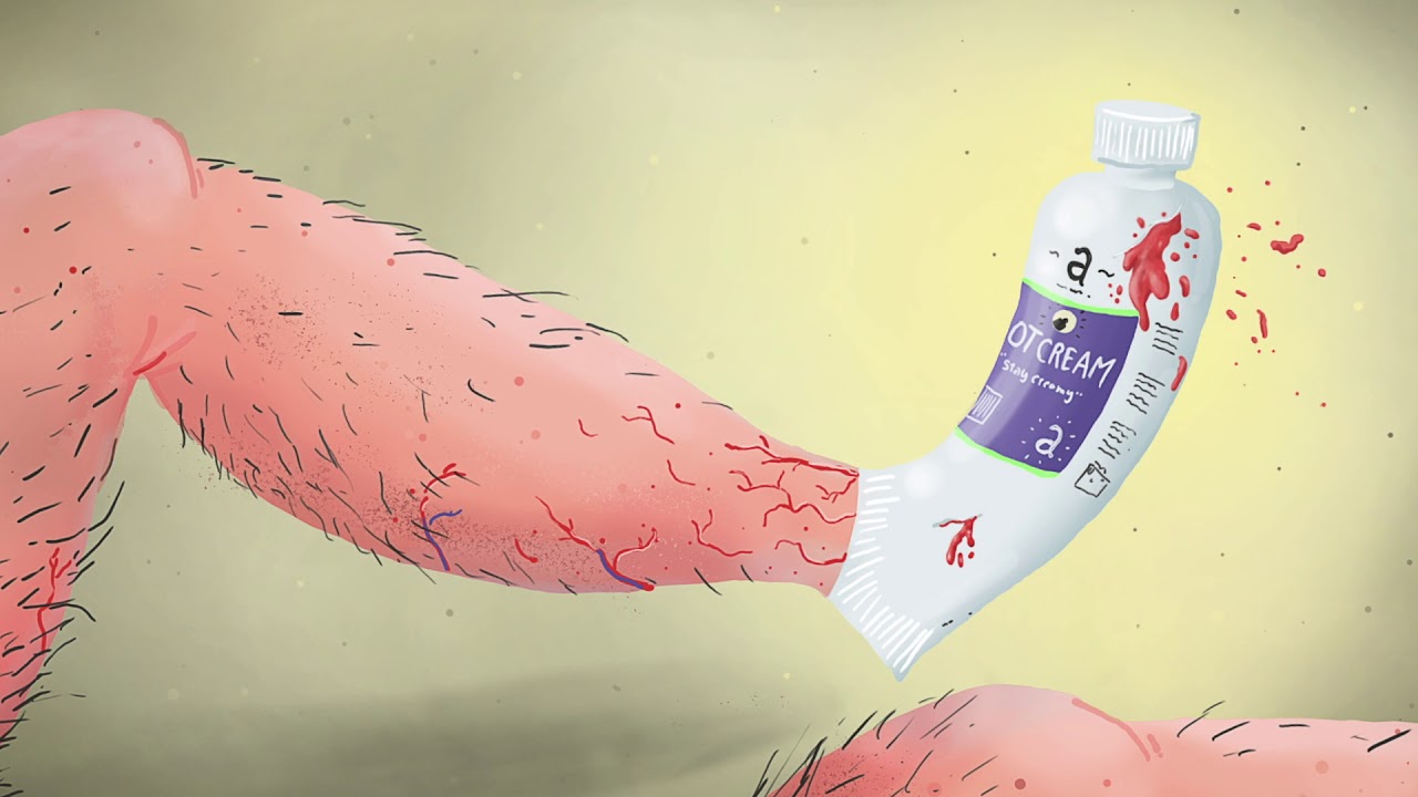 A case study: Speech recognition software