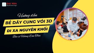 Thực hành chỉnh nha: Hướng dẫn bẻ dây cung vói 3D di xa nguyên khối