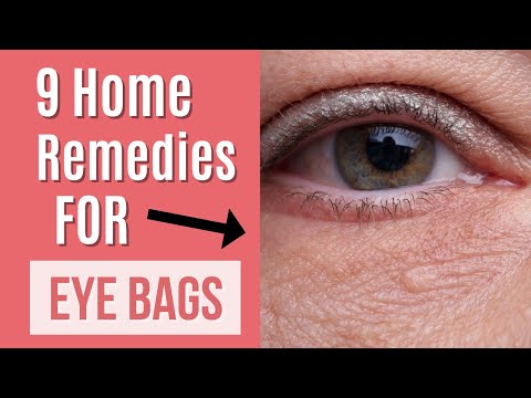 9 Home Remedies For Eye Bags  -  Quick Fix