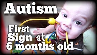 AUTISM: First Sign at 6 months old