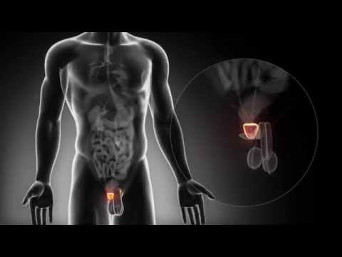 Bryansk biopsia prostatica Quali preparativi sono necessari per il trattamento di adenoma prostatico