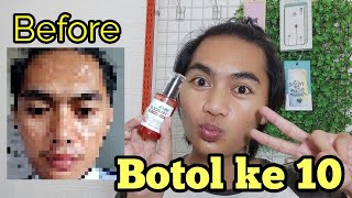Download lagu snail truecica review botol ke 10 mp3