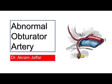Abnormal (Aberrant) Obturator Artery (Corona Mortis)