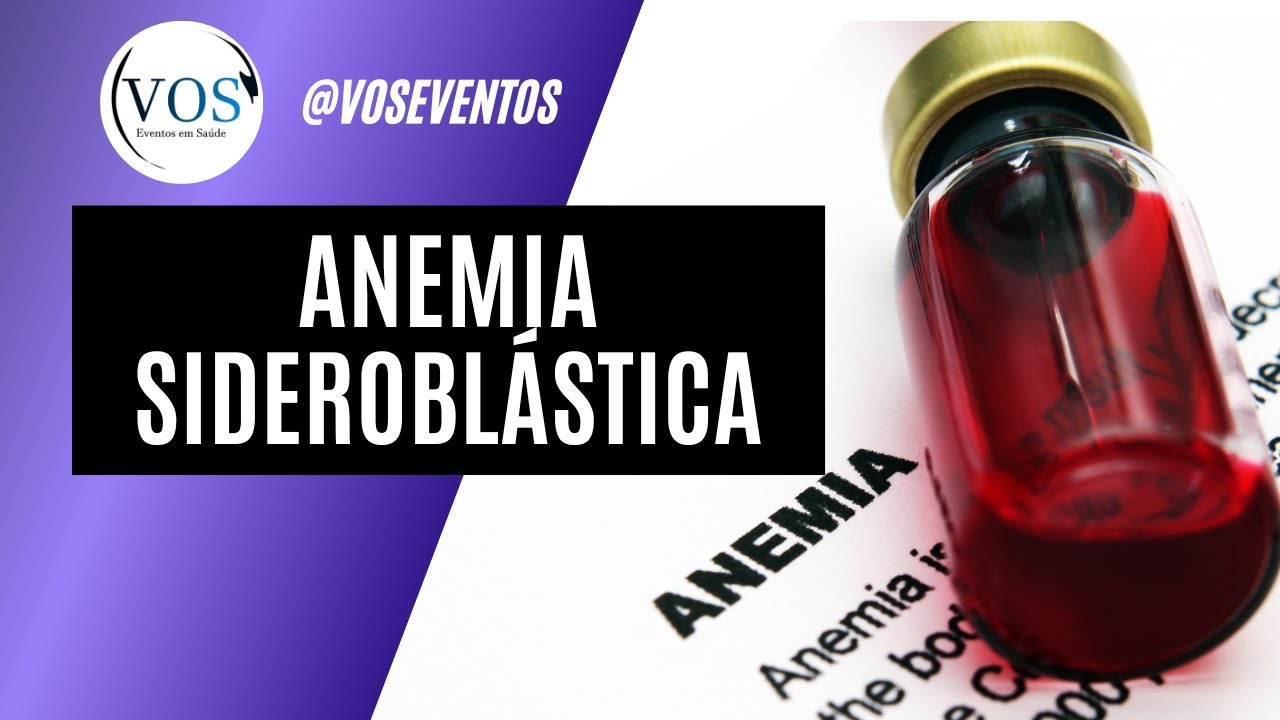 Anemia Sideroblástica