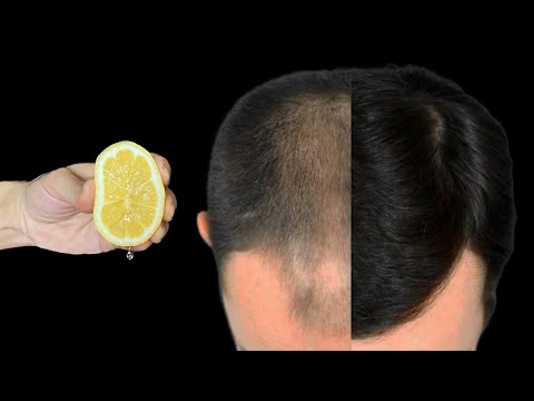 I just tried it and my hair growth doubled in a month 🔥