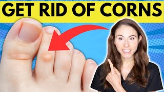How To Get Rid Of Corns On The Feet
