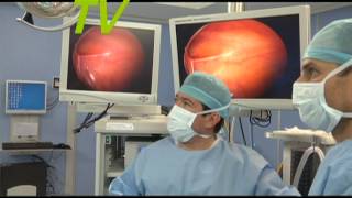 Cirugía laparoscópica infantil, hernia umbilical [Clínica Las Condes]