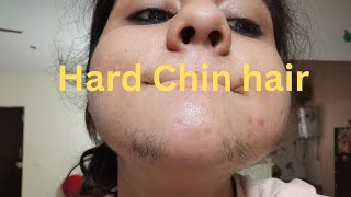 Extreme hard Chin hair Removal| मर्दों जैसे बाल तुरंत हटाओ|How to remove hard Chin hair|
