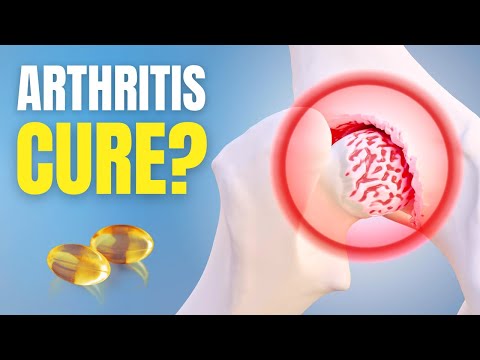 Arthritis? You're Treating It Wrong! See How to Actually Repair Cartilage