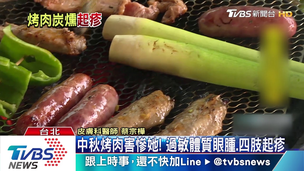 中秋烤肉害慘她! 過敏體質眼腫、四肢起疹