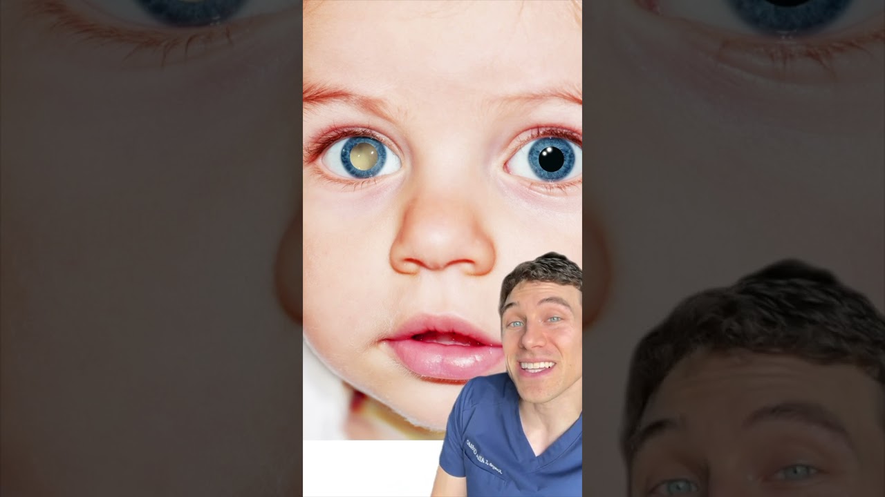 Your EYES tell me THIS about your Health  #eyedoc