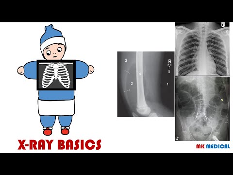 Chest X-ray interpretation (Part 1)