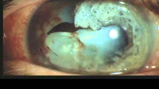 XIU XIU - HIVES HIVES (LIVE FROM PARADISO)