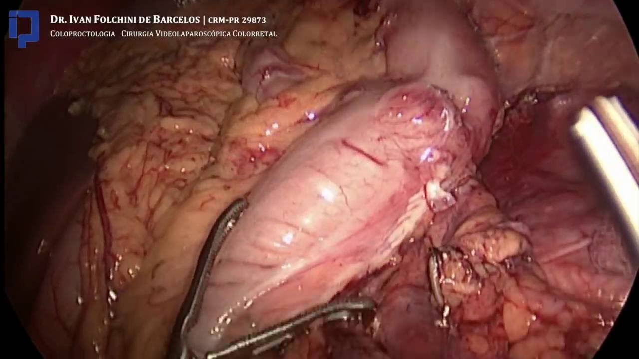 Ivan Folchini De Barcelos-2