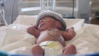 Download lagu Emerson James Castellano - St. Jude Fullerton NICU mp3