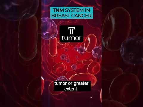 Dive into the TNM system and its role in breast cancer staging 🎗️🔬