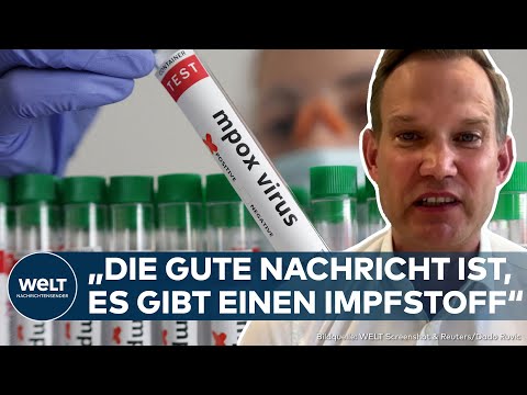 AUSBREITUNG VON MPOX: Wie gefährlich ist die neue Variante wirklich? Virologe Streek kann beruhigen