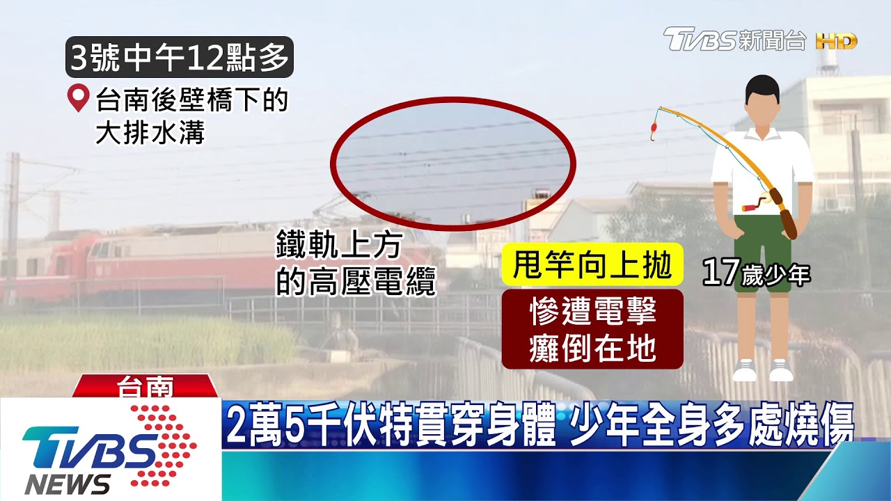 甩竿誤觸高壓電 17歲少年慘遭電擊重傷