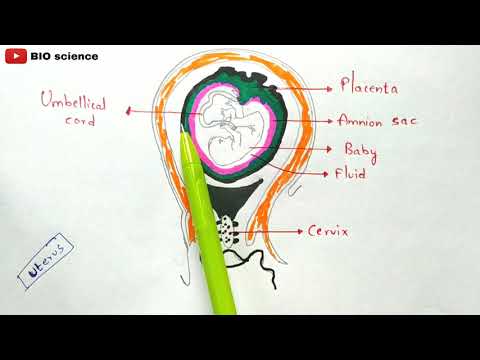 Typhoid fever Salmonella typhi Causes symptoms diagnosis treatment Bio science