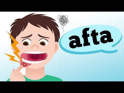 AFTAS: CARACTERÍSTICAS E SURGIMENTO