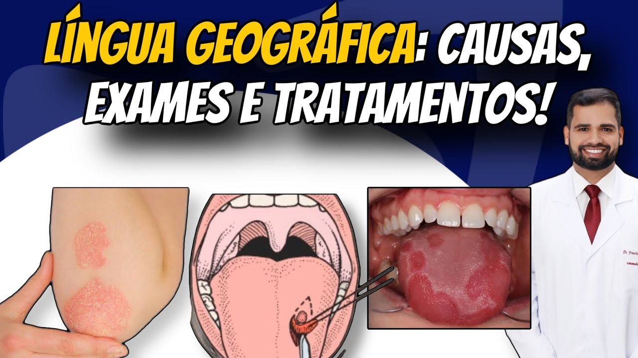 Francisco De Assis Almeida Lima Júnior-116