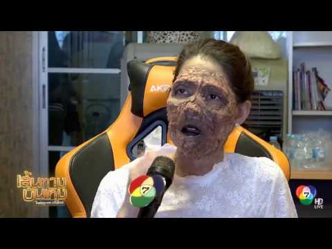 คลิกเพื่อดูคลิปวิดีโอ