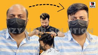 Hair Patches For Mens | Non surgical hair treatment | formal hair style in wig |