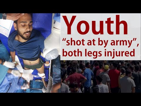 Youth "shot at by army", both legs injured
