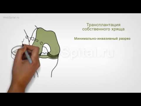 Грыжи шморля грудного отдела позвоночника лечение упражнения Болит шея с правой стороны сзади как лечить