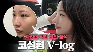 모두의 워너비 자려한 직반 코 | 코성형 브이로그