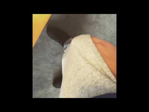 Azet Bein angeschwollen / Nummer 1 nur für Mama