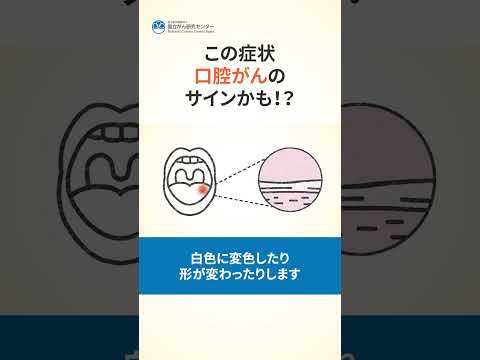 ショー優勝者、稀な腫瘍の診断を説明「口内炎だと思った」