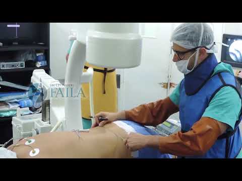 Gomito rotto Se è necessario dare iniezioni in articolazioni con osteoartrite