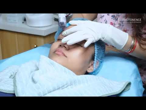 DERMAFRAC Treatment | Beyond Aesthetics