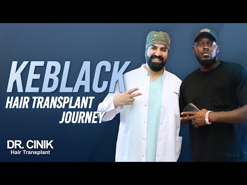 Keblack’s Hair Transplant Journey | Hair Transplant | Dr. Emrah Cinik