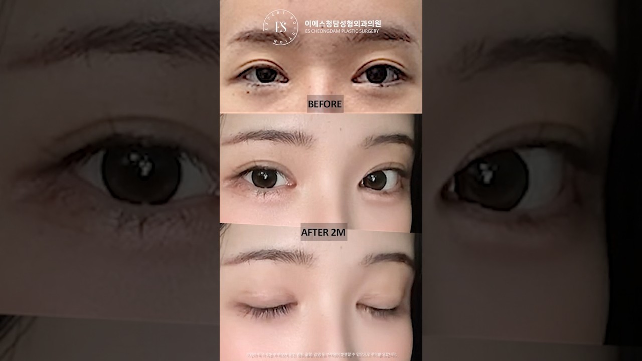 이에스 유튜브