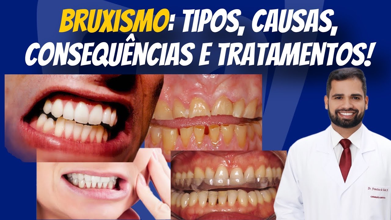 Francisco De Assis Almeida Lima Júnior-103